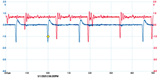 thumbnail scope trace