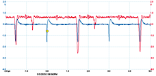 thumbnail scope trace
